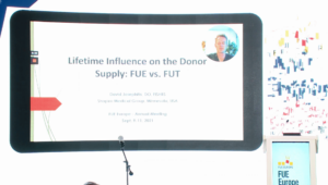 David Josephitis, MD - Lifetime Influence on the Donor Supply: FUE vs. FUT & WAW device and punches