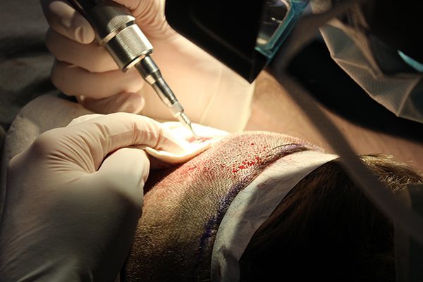 Live Surgery Education2